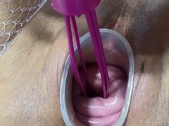 Mature wife fucking cervix and penetration in uterus